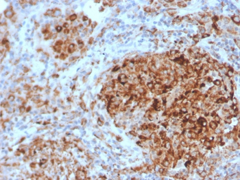 HAVCR2 Antibody