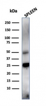 HAVCR2 Antibody