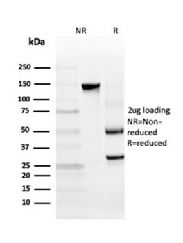 HAVCR2 Antibody
