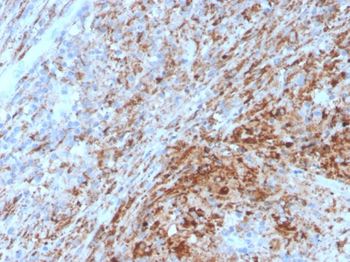 HAVCR2 Antibody