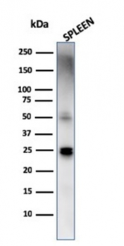 HAVCR2 Antibody