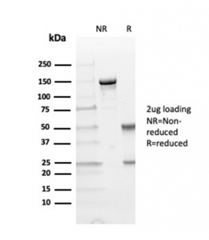 HAVCR2 Antibody