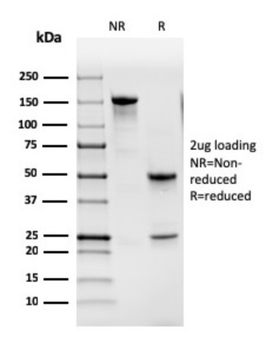 CSF2 Antibody