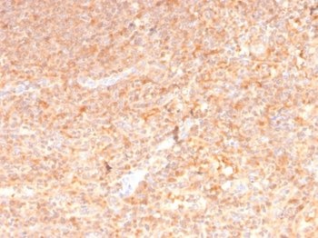 CSF2 Antibody