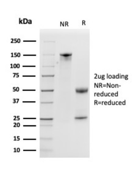 KLK5 Antibody