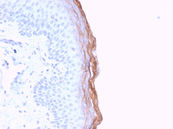 KLK5 Antibody