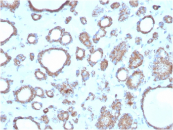RHOBTB2 Antibody