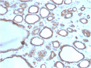RHOBTB2 Antibody