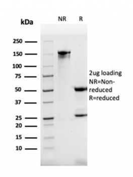 RHOBTB2 Antibody