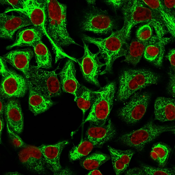 Cytokeratin 14 (KRT14) (Squamous Cell Marker) Antibody