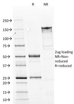 Cytokeratin 14 (KRT14) (Squamous Cell Marker) Antibody