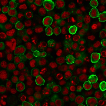 FUT4 Antibody