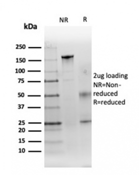 CA9 Antibody