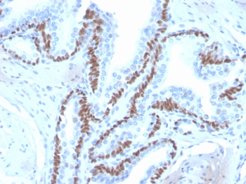 TP63 Antibody