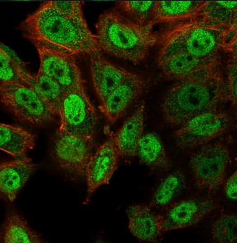 TP63 Antibody