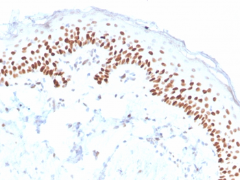TP63 Antibody