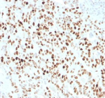 CDKN1A Antibody