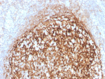 CR1 Antibody