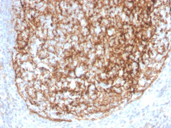CR1 Antibody