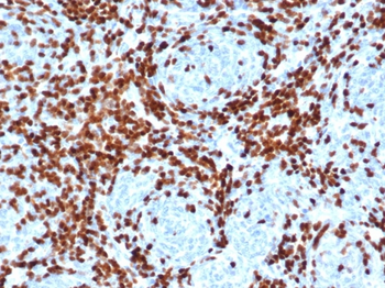 DNTT Antibody