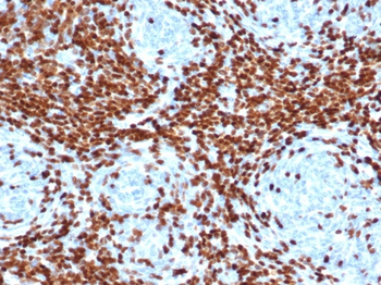 DNTT Antibody