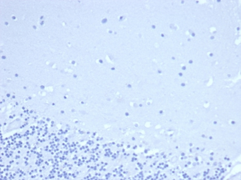DNTT Antibody