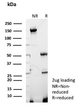 DNTT Antibody