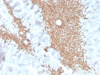SATB2 Antibody