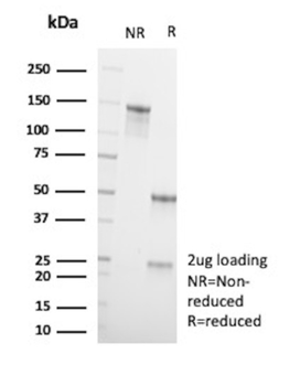 SATB2 Antibody