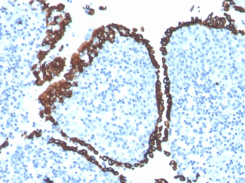 KRT5 Antibody