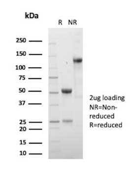 KRT5 Antibody