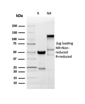 MBP Antibody