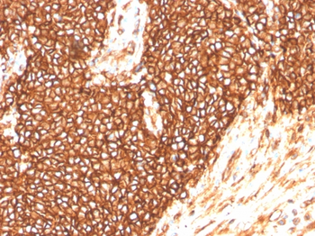 CD99 Antibody