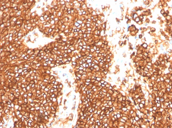 CD99 Antibody