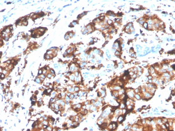 MUC1 Antibody