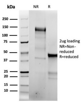 TOP2A Antibody