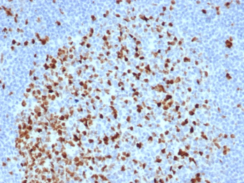 TOP2A Antibody