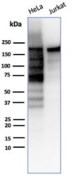TOP2A Antibody