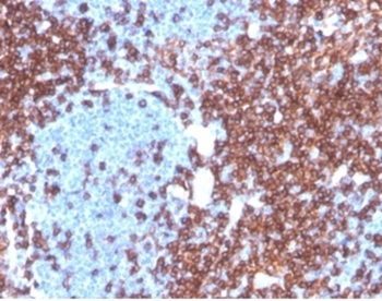 CD4 Antibody