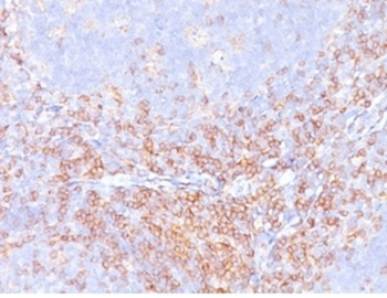 CD4 Antibody