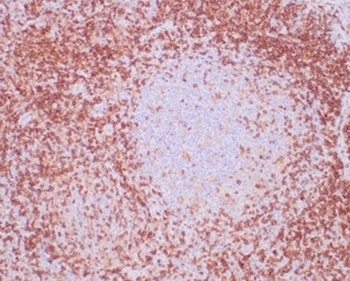 CD4 Antibody