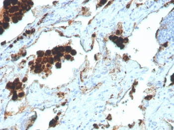 NAPSA Antibody