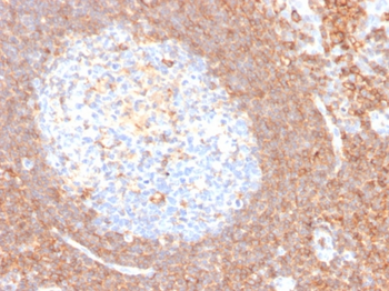 CD44 Antibody