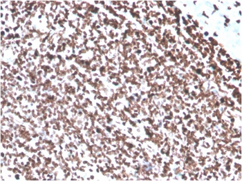 Recombinant Double Stranded DNA (dsDNA) (Nuclear Marker) Antibody