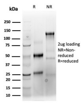 KRT76 Antibody