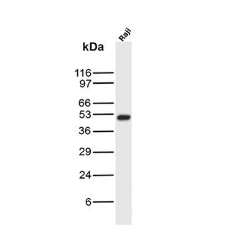 KRT76 Antibody