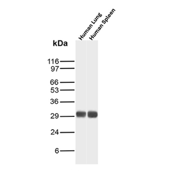 KRT76 Antibody