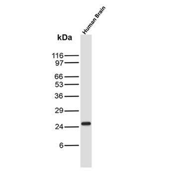 KRT76 Antibody