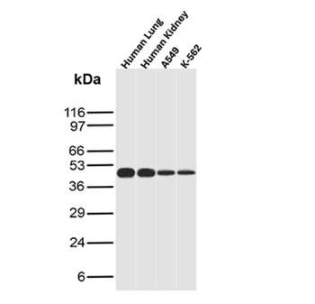 KRT76 Antibody