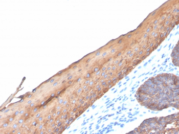 KRT77 Antibody